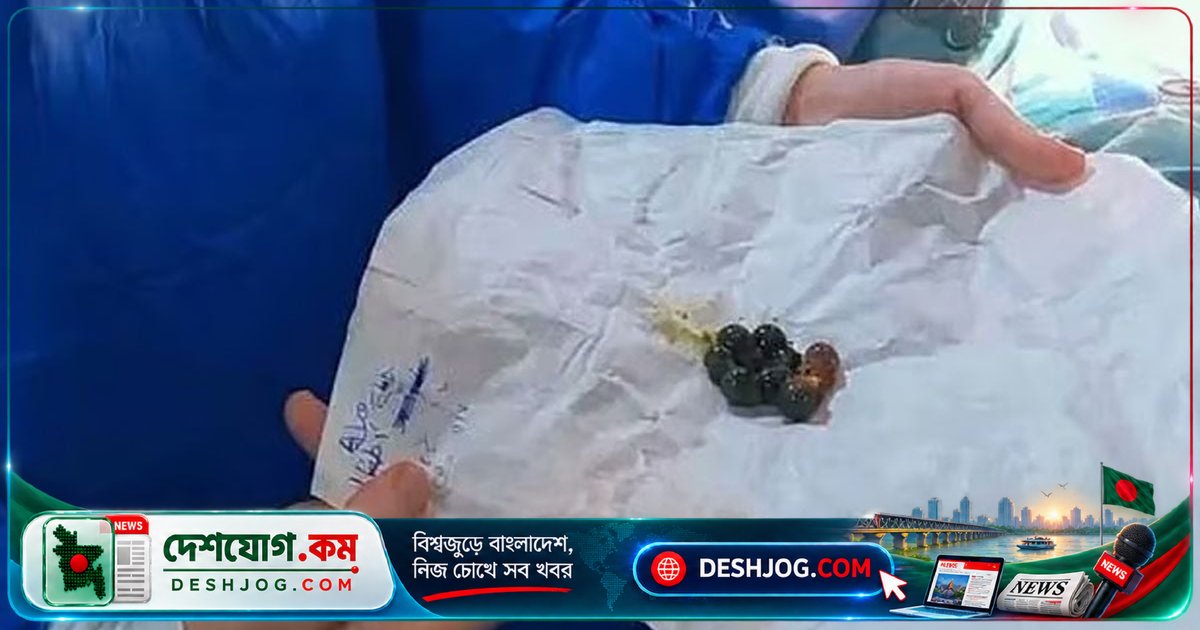১৩ বছর বয়সী মিসরীয় কিশোরীকে পেট থেকে বের করা হয় ১৪টি চুম্বক, অস্ত্রোপচার ছাড়াই সফল চিকিৎসা