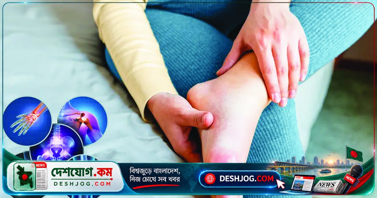 আর্থ্রাইটিসের আশঙ্কাজনক পরিসংখ্যান: বাংলাদেশে ৩০% মানুষের জয়েন্ট সমস্যা, নারীদের আক্রান্ত হওয়ার হার বেশি