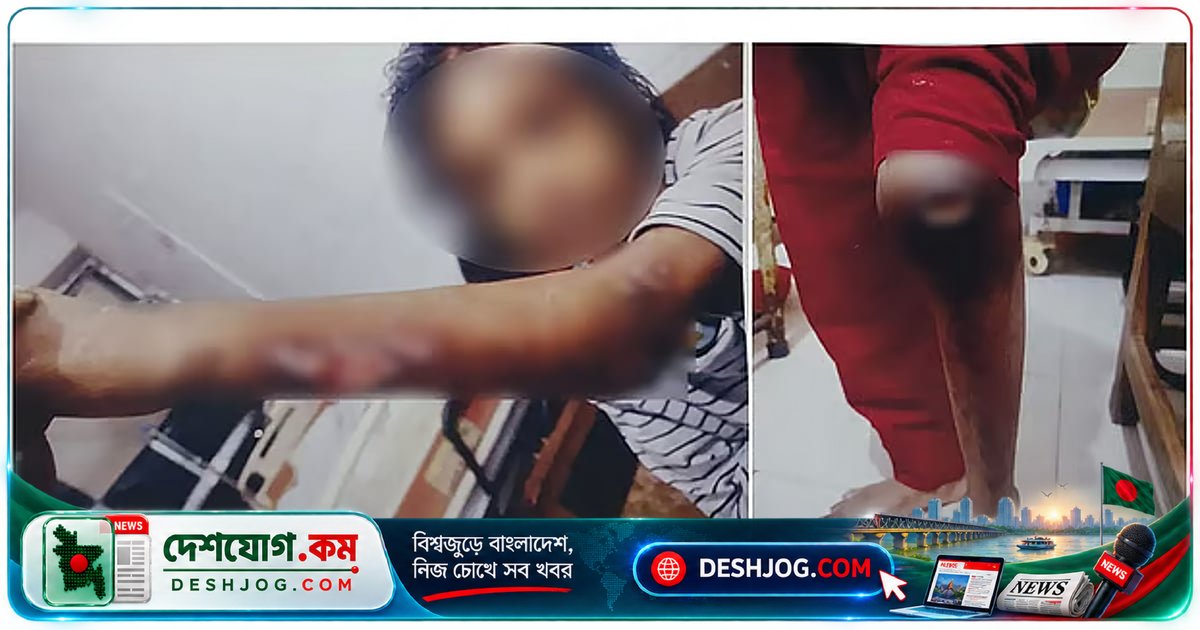 বিমান বাংলাদেশের সাবেক এমডির বাসায় ১১ বছর বয়সী শিশু নির্যাতনের অভিযোগ: গরম খুন্তি, মরিচের গুঁড়া ও দাঁত ভাঙা