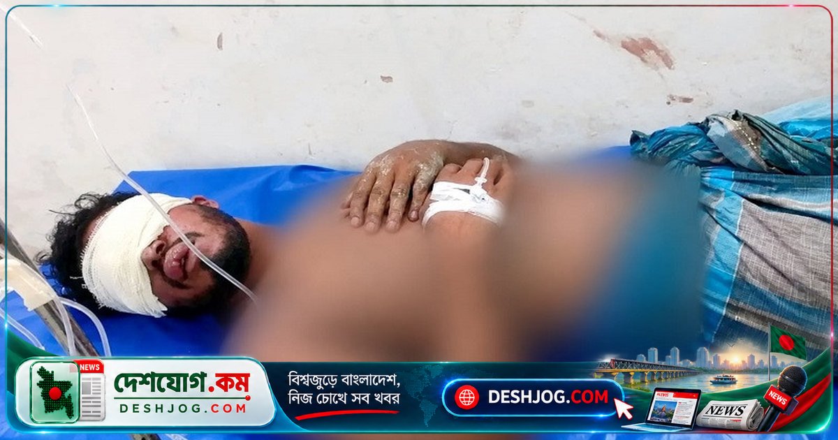 ভোলার বোরহানউদ্দিনে মাইক্রোবাসে তুলে নেওয়া যুবককে দুর্বৃত্তরা চোখ নষ্ট করে ফেলে, পুলিশ গ্রেপ্তার করে আসামি