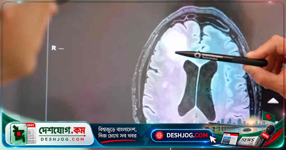 মাত্র দুই ঘণ্টায় শনাক্ত হবে মস্তিষ্কের টিউমার: যুক্তরাজ্যে নতুন জিনগত পরীক্ষা চালু