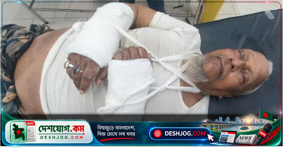 চাঁদপুরে সাবেক ইউনিয়ন চেয়ারম্যানের দুর্বৃত্ত হামলায় ভেঙে যায় দুই হাত, হাসপাতালে ভর্তি