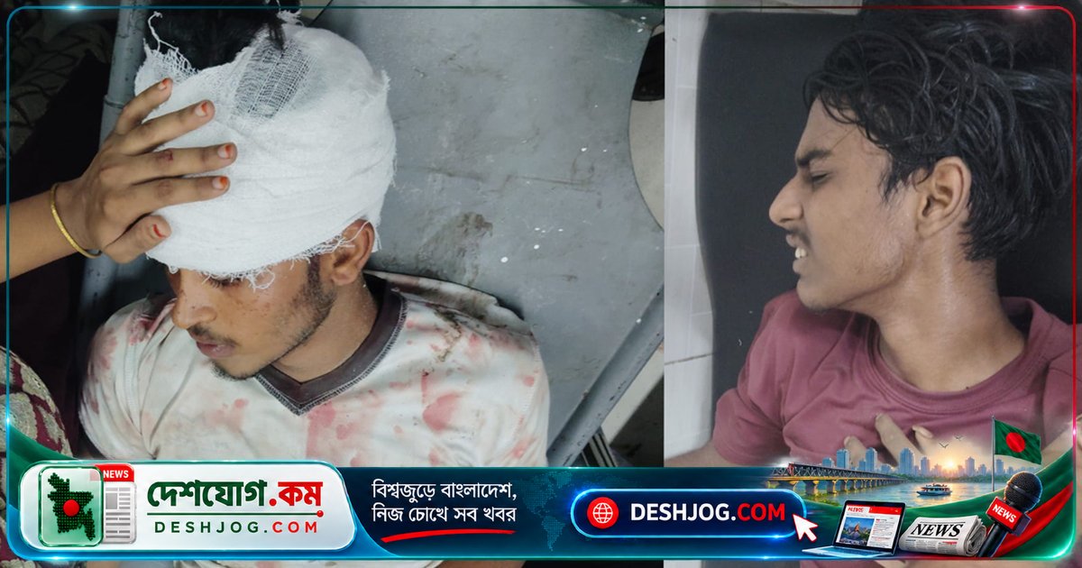 চাঁপাইনবাবগঞ্জে কিশোরদের দুই দলের মারামারিতে চারজন গুরুতর আহত