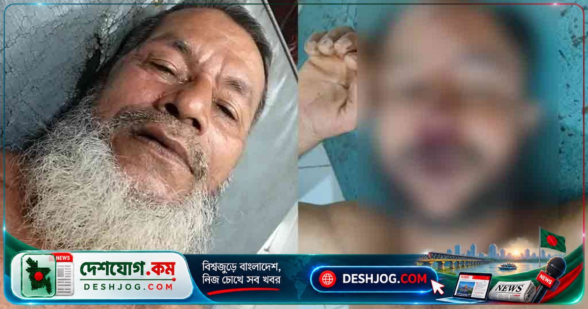 চট্টগ্রামের আনোয়ারায় মামলার বাদী ও পরিবারের ওপর হামলায় দুজন আহত, জামিনে বেরিয়ে অভিযুক্তরা হুমকি দিচ্ছিল