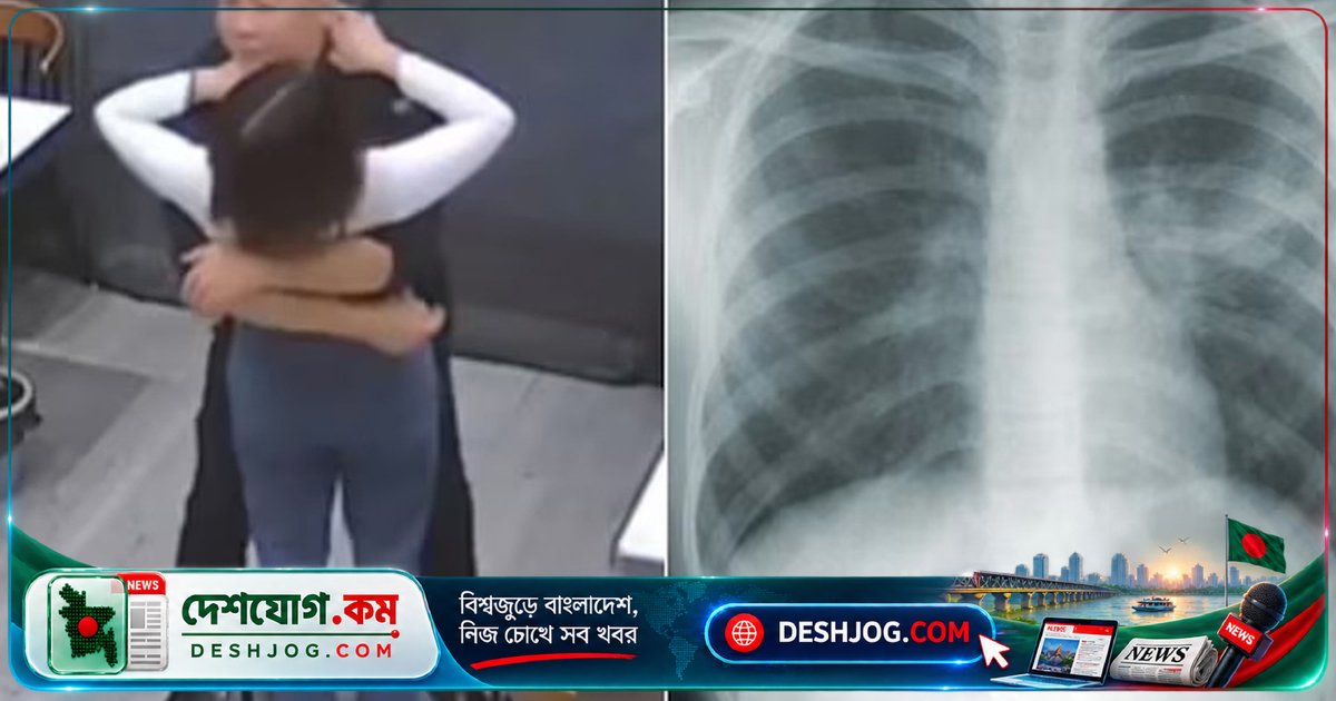 আদরের আলিঙ্গনে ভেঙে যায় পাঁচটি পাঁজর: চীনের নারী হাসপাতালে