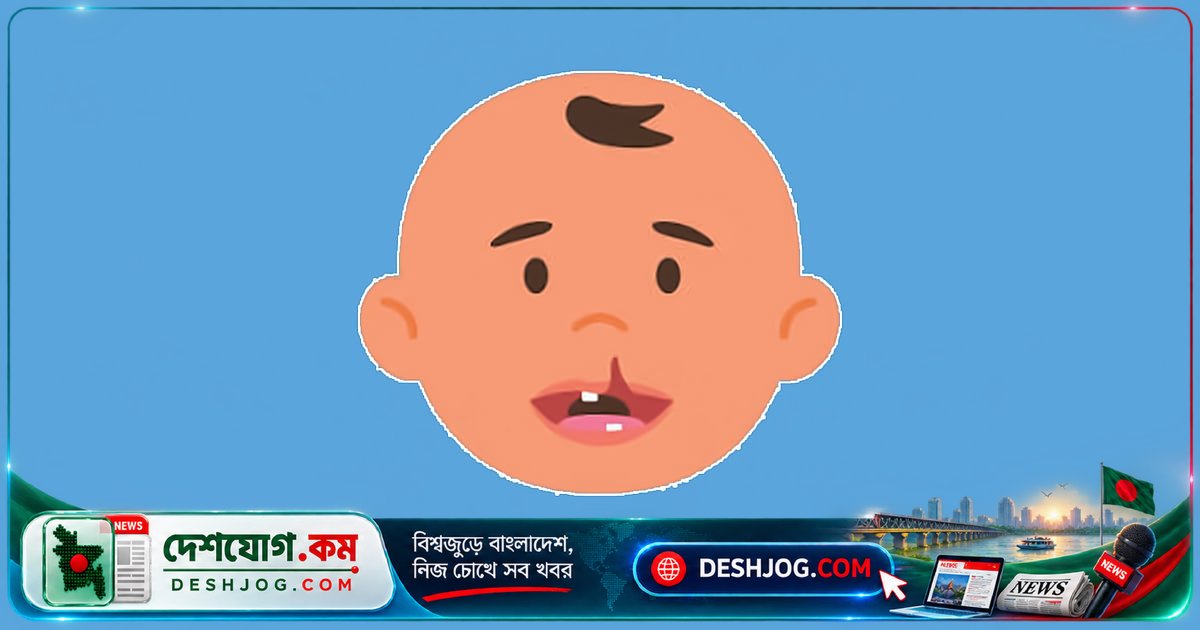 ঠোঁট ও তালুকাটা: জন্মগত ত্রুটি নয় অভিশাপ, চিকিৎসা ও যত্নের পথে আশা