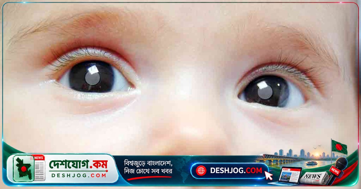জন্মগত ছানি: শিশুদের দৃষ্টিশক্তি বিকাশে নিরাপদে বাঁচানোর গোপন উপায়