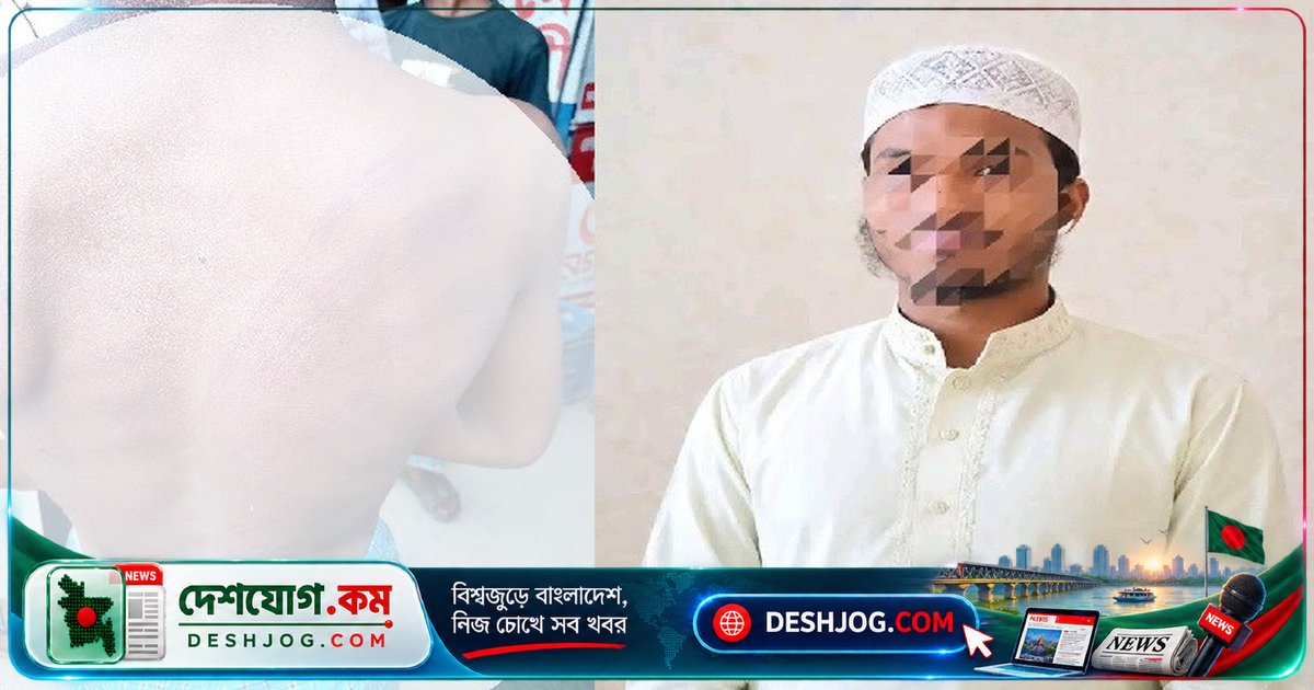 কক্সবাজারের মাদ্রাসায় শিশুকে নির্যাতন ও চুল কেটে দেওয়ার অভিযোগে শিক্ষক গ্রেপ্তার