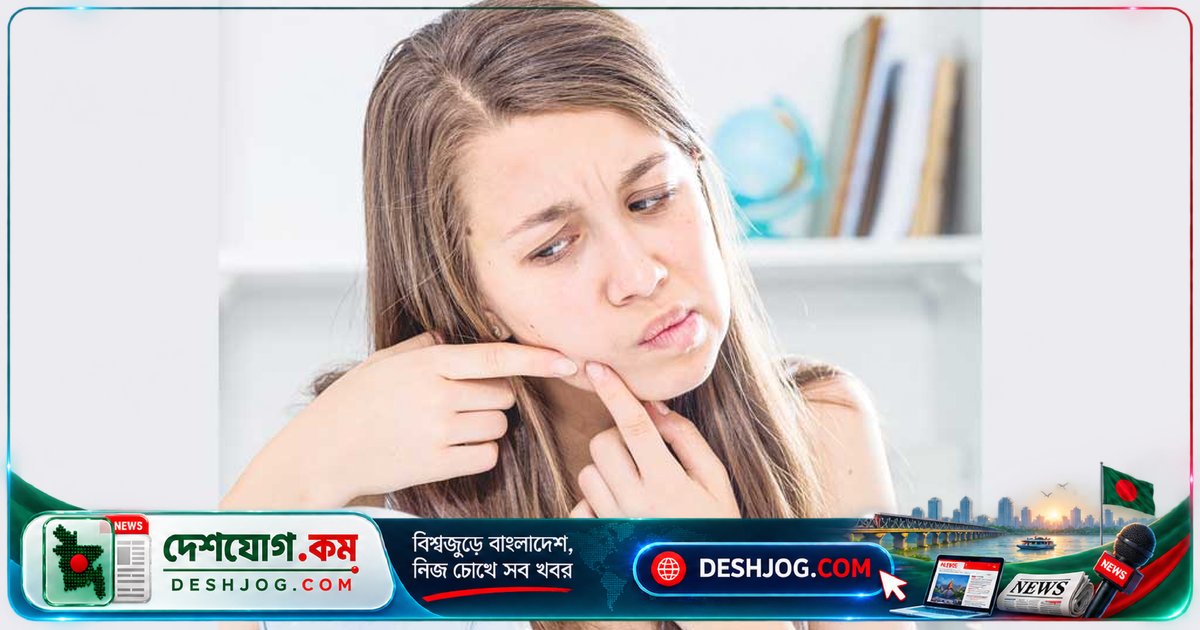 মুখের ব্রণ খোঁটা করলে হতে পারে মস্তিষ্কের মারাত্মক সংক্রমণ: চিকিৎসকের সতর্কবার্তা