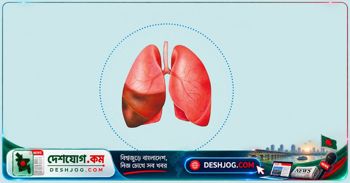 ডায়াবেটিস রোগীদের নিউমোনিয়া: ঝুঁকি ও জটিলতা কেন বেশি?