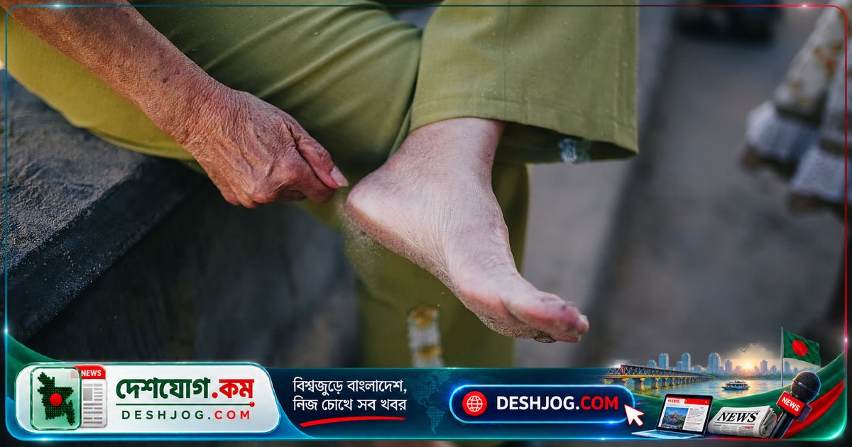 ডায়াবেটিসের পায়ে জটিলতা মোকাবেলায় ডায়াবেটিক ফুট সার্জারির গুরুত্ব ও পদ্ধতি