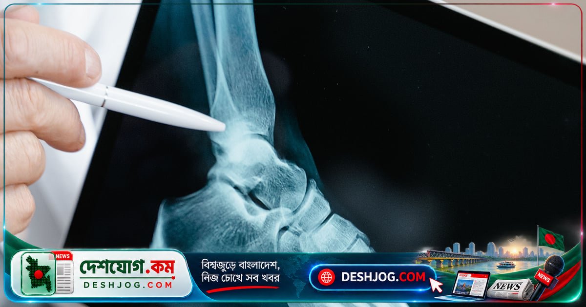 হাড়ের শক্তি বজায় রাখতে অবশ্যই খেতে হবে এই তিনটি পুষ্টি