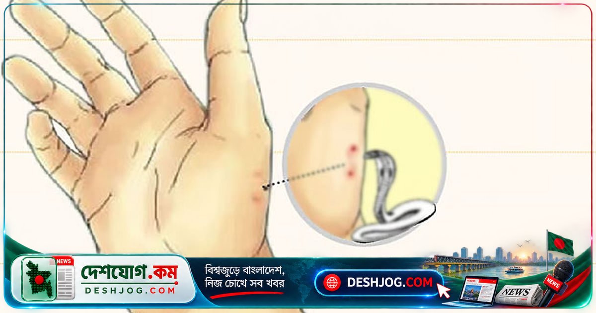 রাসেলস ভাইপার দংশন করে মেয়েকে — বাবা বোতলে বন্দী করে হাসপাতালে নিয়ে আসেন