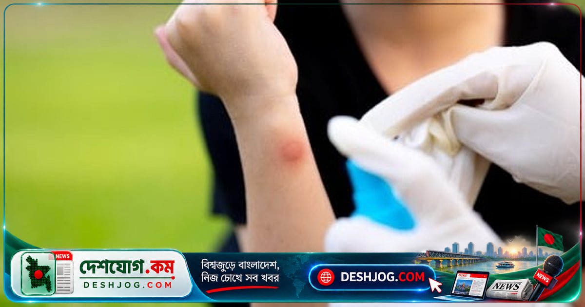 গরম-আর্দ্র আবহাওয়ায় ছত্রাকের সংক্রমণ: শরীরের কোথায় বেশি হয়, কেন হয় ও কীভাবে চিকিৎসা?