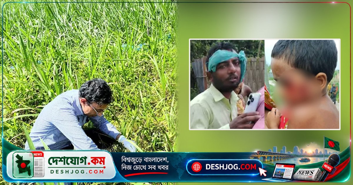 গাইবান্ধা: র্যাবিস ভাইরাসে আক্রান্ত কুকুর-শিয়ালের কামড়ে আহত ১১ জন, এক শিশু মৃত্যুবরণ