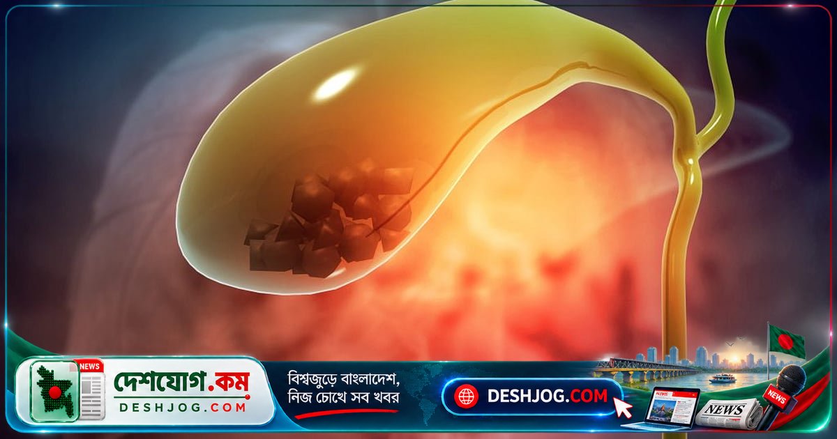 পিত্তনালির পাথর: লক্ষণ, ঝুঁকি ও চিকিৎসা পদ্ধতি সম্পর্কে বিস্তারিত