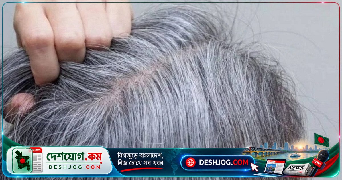 চুল পাকার পেছনে লুকিয়ে আছে ক্যানসার প্রতিরোধের গোপন কৌশল: গবেষণায় নতুন আবিষ্কার