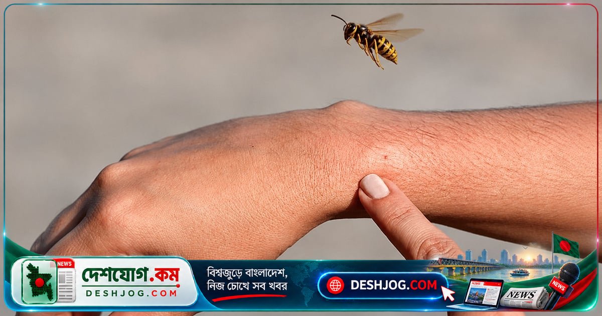 ভিমরুলের কামড়ে মৃত্যুঝুঁকি এড়াতে যা করবেন জেনে নিন