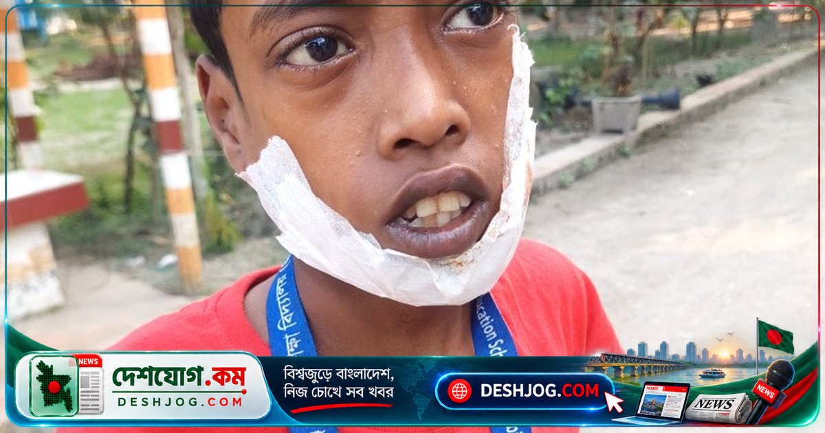 প্রতিবন্ধী বড় ভাইয়ের গালে কামড় দিয়ে মাংস তুলে নিল ছোট ভাই: জামালপুরের দুঃখজনক ঘটনা