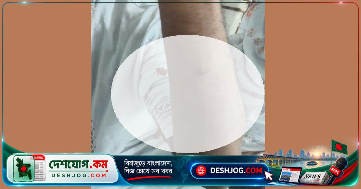 জয়পুরহাট হাসপাতালে চিকিৎসকের মারধর অভিযোগ: রিপোর্ট দেখাতে গিয়ে স্বজনকে আঘাত পেতে বাধ্য
