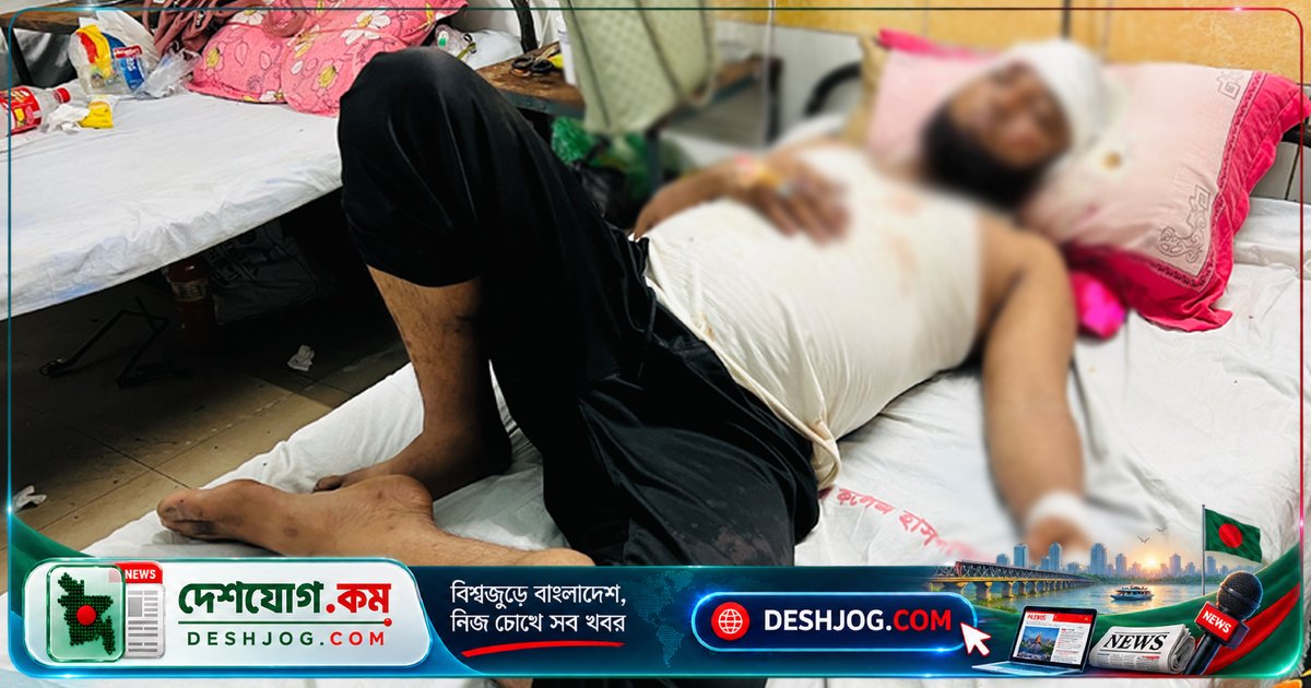 কুমিল্লা: জমিজমা বিরোধে ভাইকে দেশীয় অস্ত্র দিয়ে কুপিয়ে জখম, হাসপাতালে ভর্তি