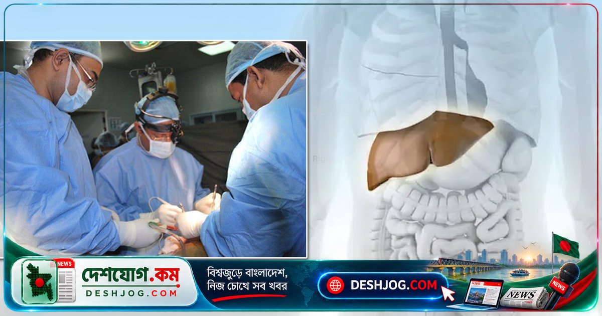 ৩০ লাখ টাকায় দেশে লিভার ট্রান্সপ্ল্যান্ট: মধ্যবিত্ত পরিবারের বোন-বোনের জীবন বদলে দিয়েছে বাংলাদেশের চিকিৎসা বিপ্লব