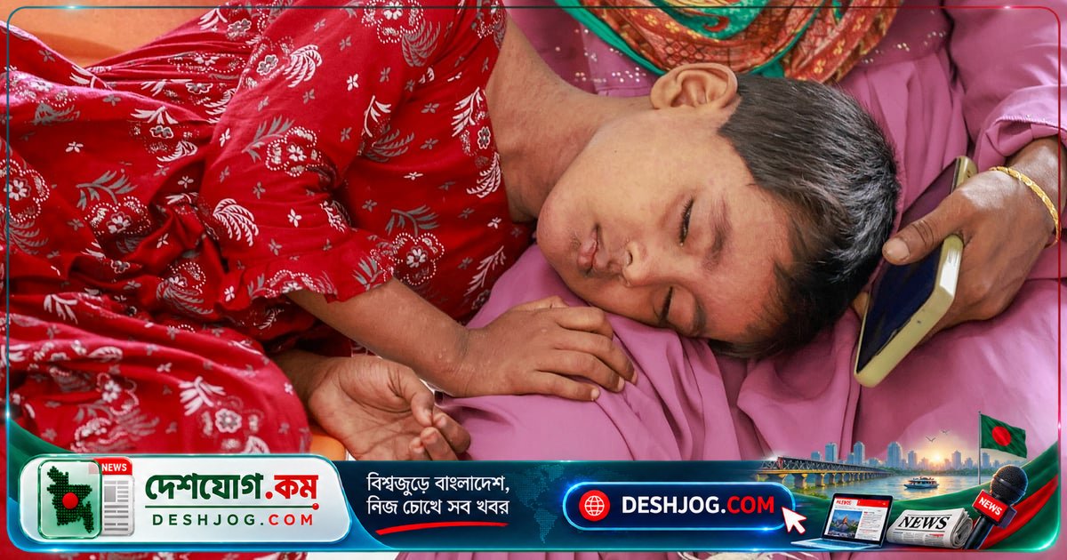 হামে মৃত্যু বাড়ছে: একদিনে তিনজন প্রাণ হারালেন, মোট মৃত্যু ৯৮৬