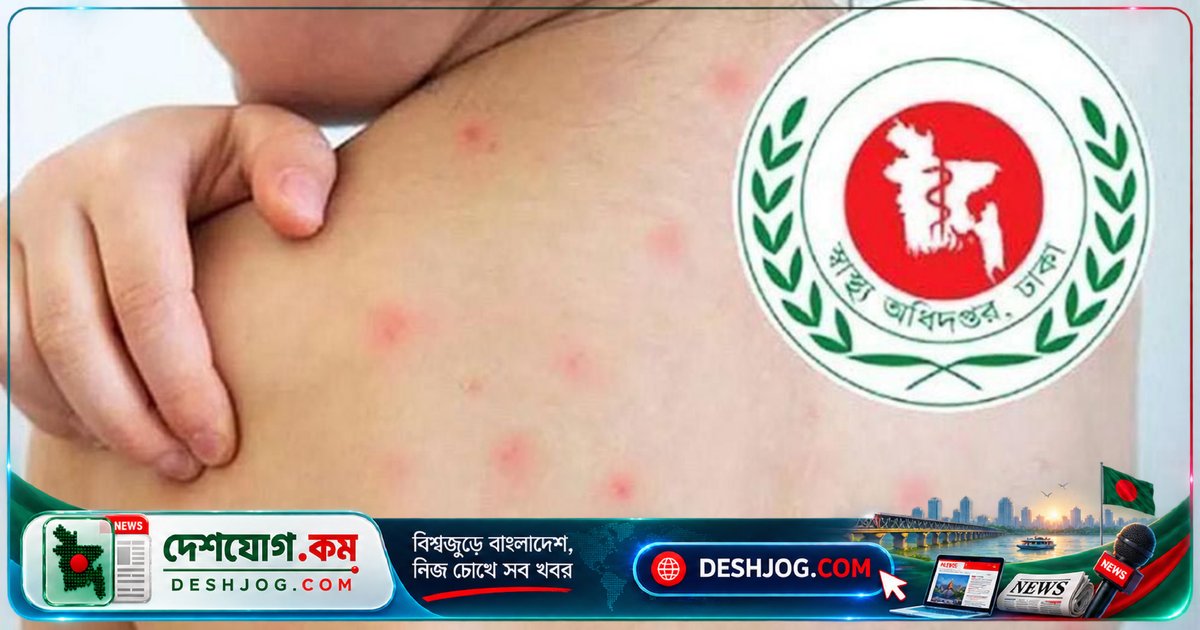 হামে মৃত্যু আরও তিন, নতুন আক্রান্ত এক হাজার চারজন