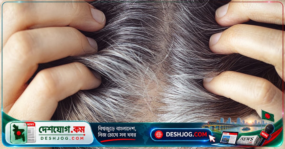 মানসিক চাপের দমে কি মাথার চুল এক রাতে সাদা হয়ে যায়? বিজ্ঞানীরা জানান কীভাবে ঘটে এই অদ্ভুত ঘটনা