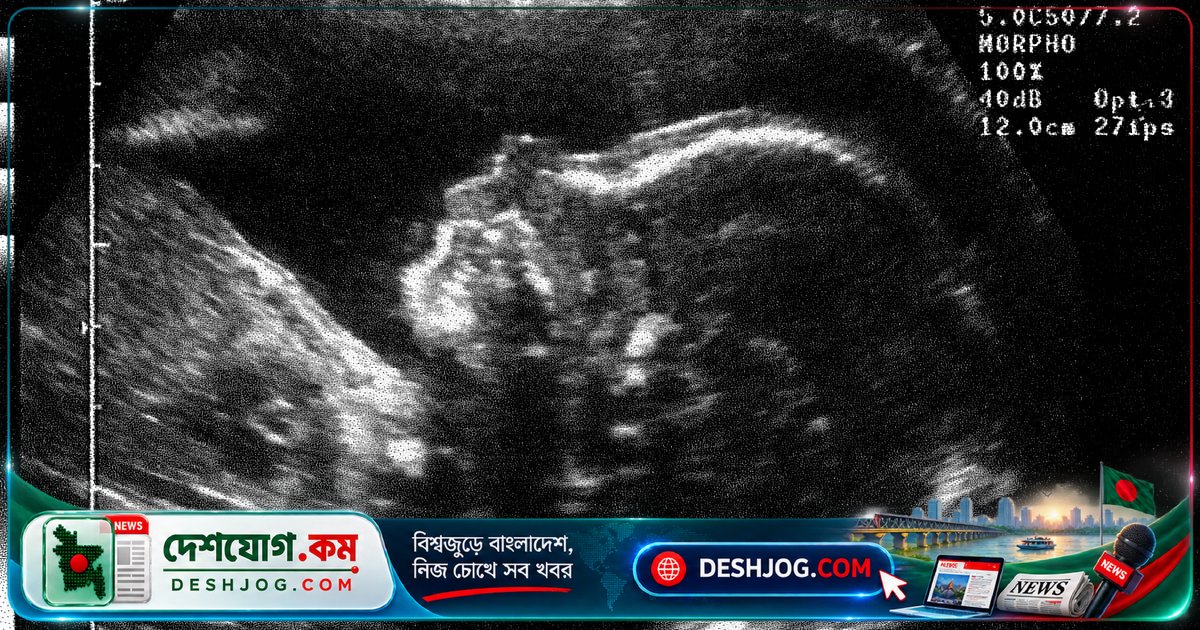 গর্ভে টিউমার ধ্বংস: মাইক্রোওয়েভ প্রযুক্তি দিয়ে শিশুর জীবন বাঁচায় চীনা চিকিৎসকরা
