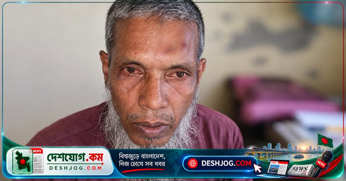 মনপুরা উপজেলায় মসজিদ উন্নয়ন কাজে শিক্ষককে মারধর: মব হামলায় গুরুতর আহত