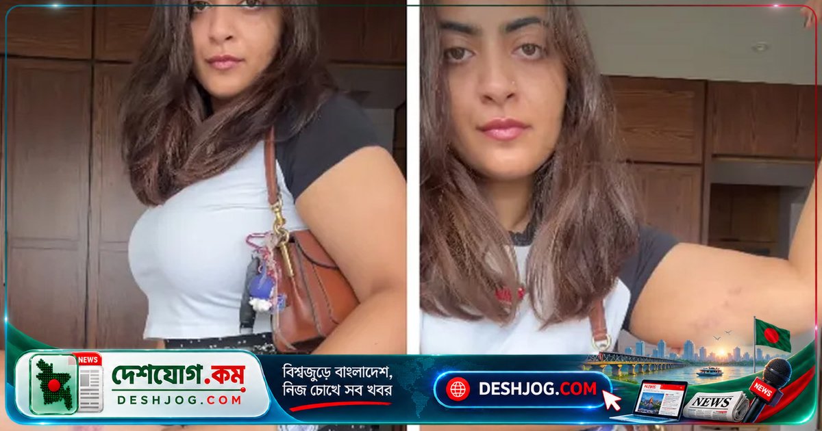 মুম্বাইতে বিক্ষোভে পুলিশি হেনস্তা: আমির খানের ভাইঝি ও তারকারা আঘাতের ছবি প্রকাশ করে অভিযোগ