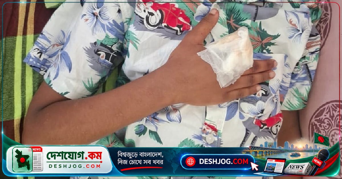 নাটোর পুলিশ কনস্টেবলের নৃশংসতা: শিশুর বিচ্ছিন্ন আঙুল জোড়া দেওয়া সম্ভব নয়, বাবা কাঁদে ক্ষতিপূরণের দাবিতে