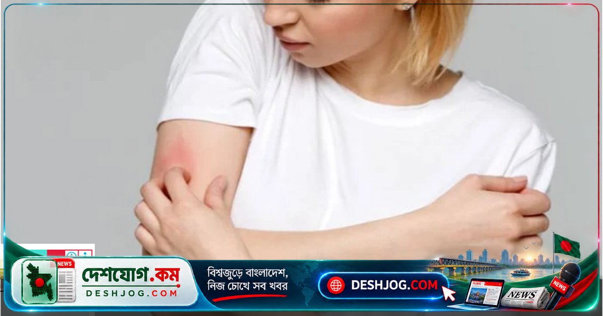 নিমপাতা ও ইসবগুলের ভুষি দিয়ে অ্যালার্জি থেকে মুক্তি পাওয়ার সহজ পদ্ধতি