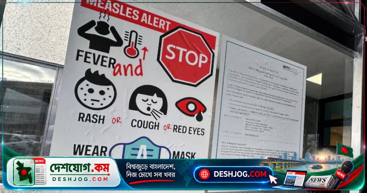 নিউইয়র্কে হামের ভয়াবহ প্রাদুর্ভাব: জরুরি অবস্থা ঘোষণা, টিকা বিতরণ ত্বরান্বিত