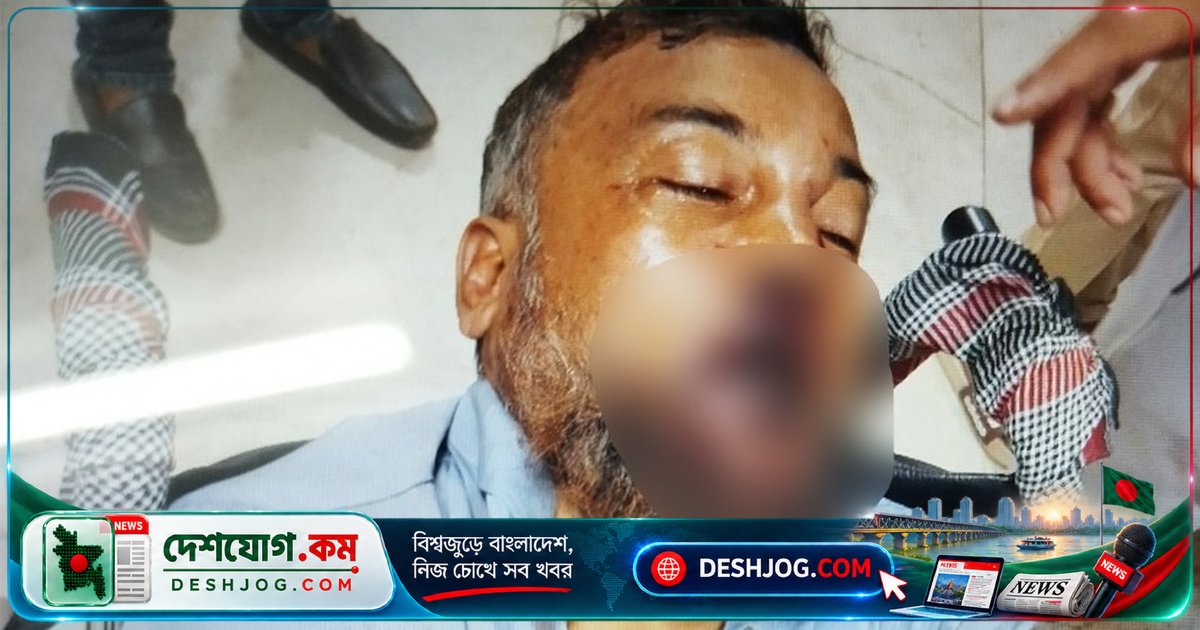 পুরানা পল্টনে ঠিকাদারকে মারধর: চাঁদা না দিলে হাতুড়ি দিয়ে আঘাত