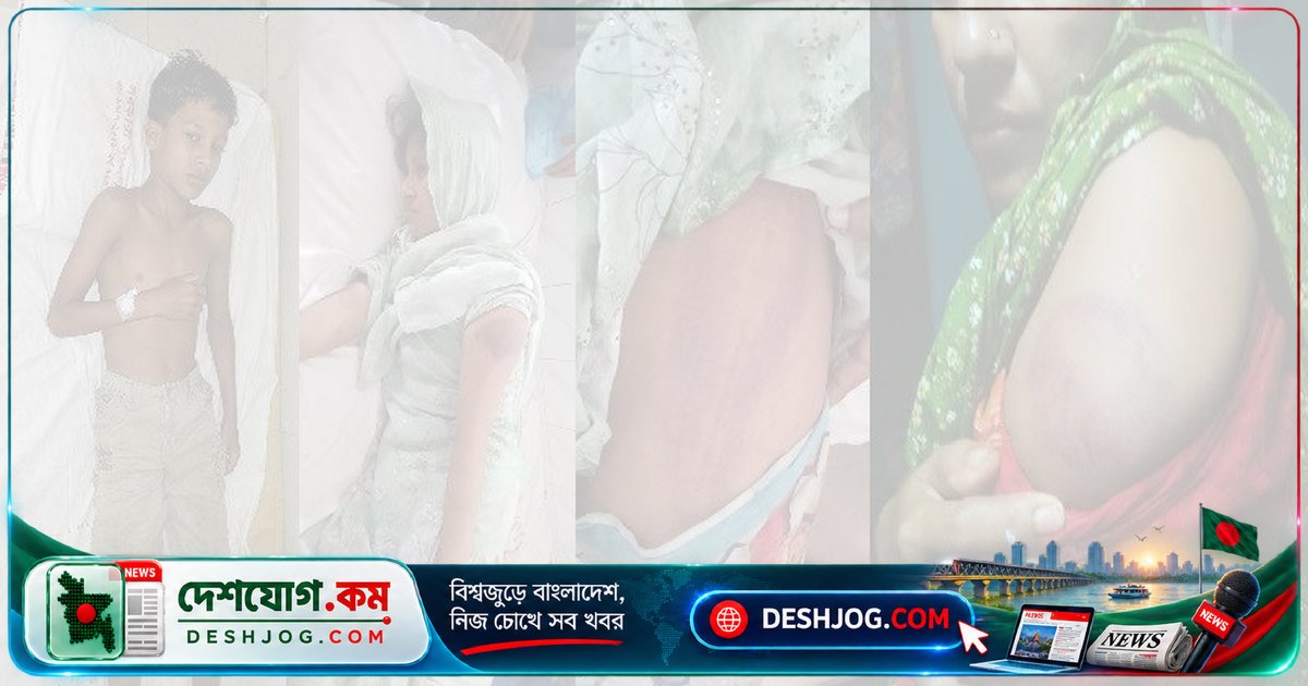 পটুয়াখালীতে পাঁচ হাজার টাকার অপবাদে শিশুকে শিকলে বেঁধে নির্যাতন, মাকে মারধর: অভিযোগে অভিযুক্তদের প্রতিক্রিয়া