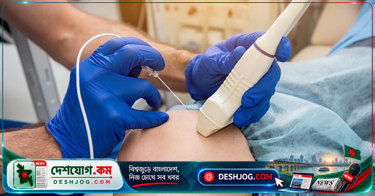 হাঁটুর ব্যথা নিয়ন্ত্রণে রেডিও ফ্রিকোয়েন্সি অ্যাবলেশন: কীভাবে কাজ করে এবং কতটা কার্যকর?