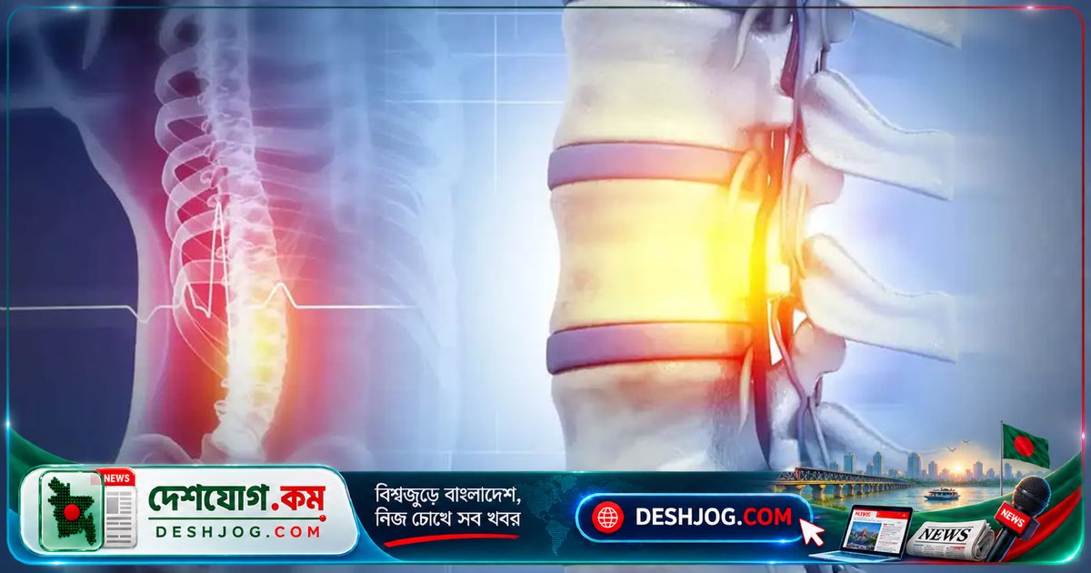 রাশিয়ায় মানব মেরুদণ্ড প্রতিস্থাপন: বিশ্বের প্রথম সফল অস্ত্রোপচার, কিন্তু বিজ্ঞানীদের উদ্বেগের সৃষ্টি
