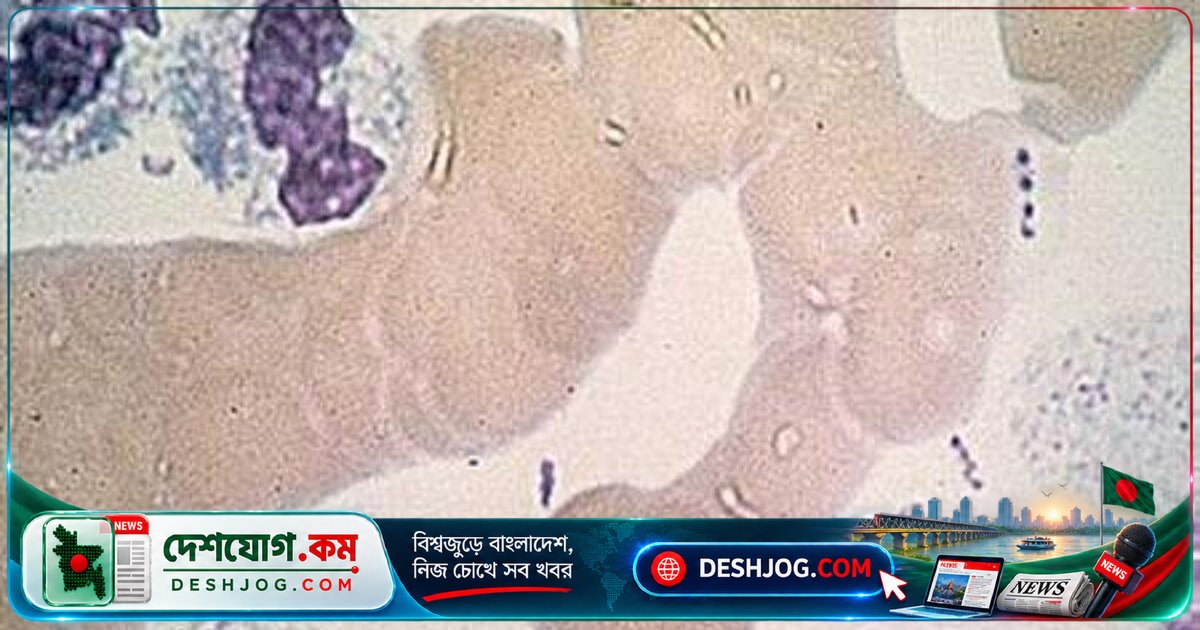 রাশিয়ায় প্লেগ গবেষণাকেন্দ্রে মৃত্যু: যুক্তরাষ্ট্র সতর্কতা জারি করে ‘আতঙ্কিত না হওয়ার’ আহ্বান জানায়