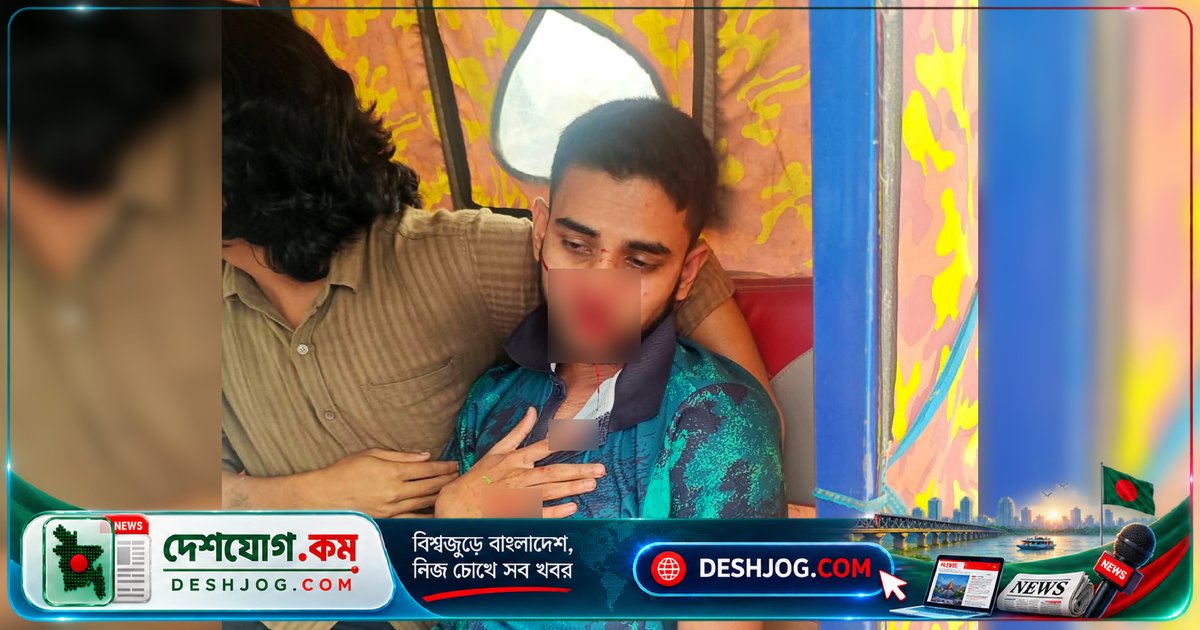 সিকৃবিতে ছাত্রলীগ কর্মী আখ্যা দিয়ে ছাত্রদল কর্মীরা মারধর করে দু’জন শিক্ষার্থীকে আহত