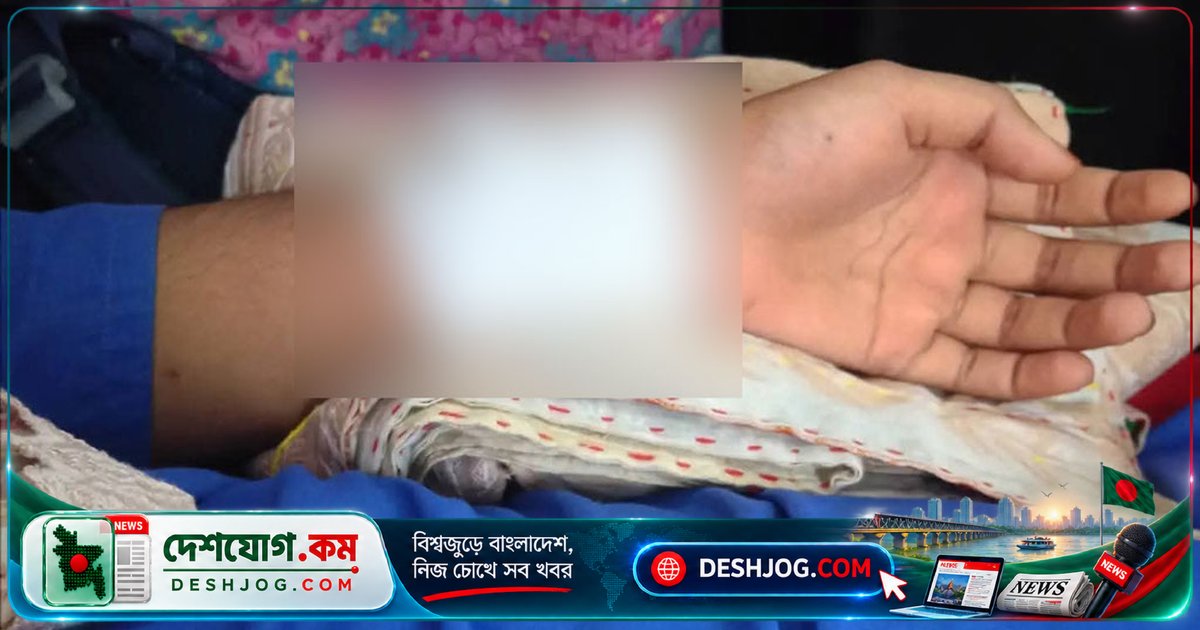 সীতাকুণ্ডে স্কুলছাত্রীকে দুর্বৃত্তরা ছুরিকাঘাত ও স্বর্ণালঙ্কার ছিনতাই করে আহত, পরিবার ভীতিসংকুল