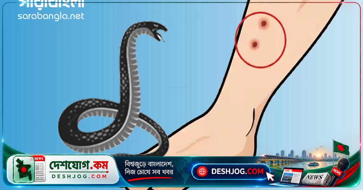 বোয়ালখালীতে সাপের কামড়ে মারা যায় ২ বছর বয়সী শিশু ইকরা