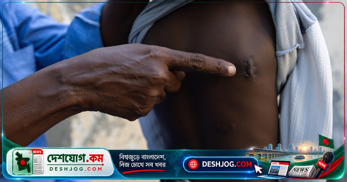 সোমালিয়ায় মার্কিন বিমান হামলার বাড়তি আঘাত: পরিবাররা কীভাবে জীবন হারায়?