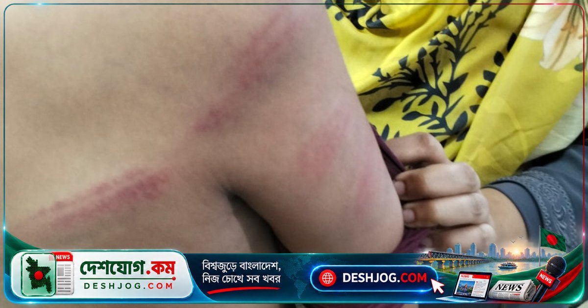 ৬ষ্ঠ শ্রেণির শিশুকে বেত দিয়ে আঘাত: পড়ে গিয়ে চিৎকার করায় শিক্ষক নির্যাতন