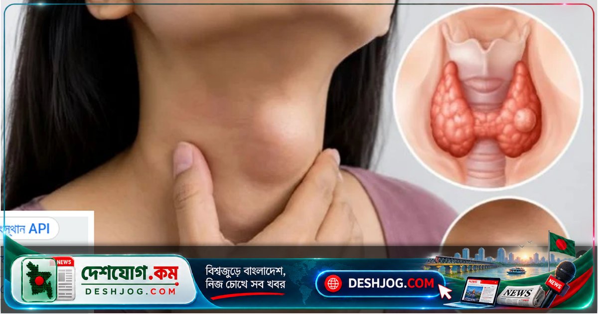 গলায় ফোলা বা গুটি দেখলে থাইরয়েড নাকি অন্য রোগ? চিকিৎসকের পরামর্শ নেওয়া জরুরি