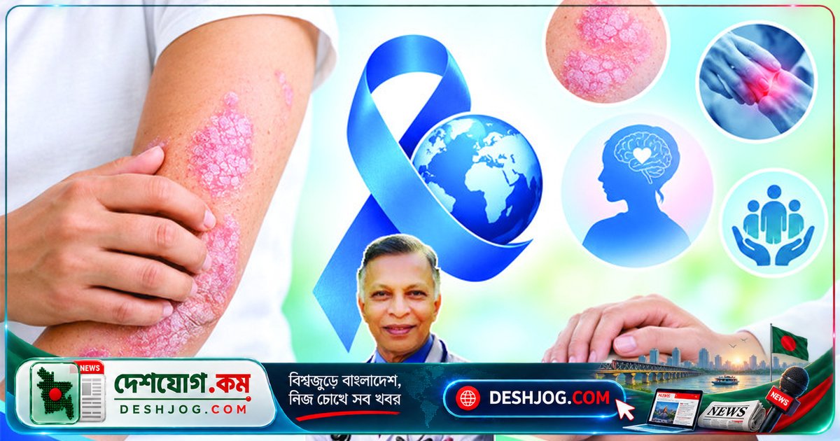 বিশ্ব সোরিয়াসিস দিবস: ত্বকের গন্ডি পেরিয়ে মানুষের মানবিকতা দেখতে হবে
